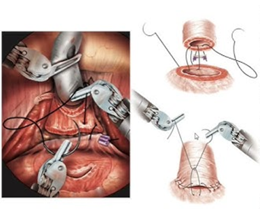 hinyoukicolum3_1_20241125.png